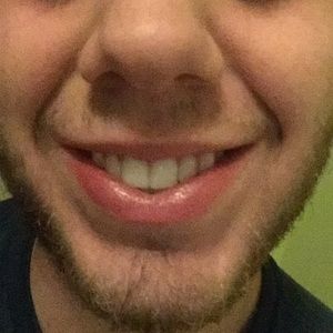 Meet your Posher, Blake